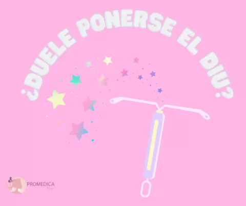 ¿Duele ponerse un DIU? Todo lo que Necesitas Saber sobre su colocación