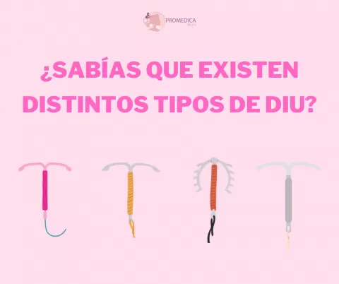 ¿Sabías que hay distintos tipos de DIU? Descubre cuál es el mejor para ti