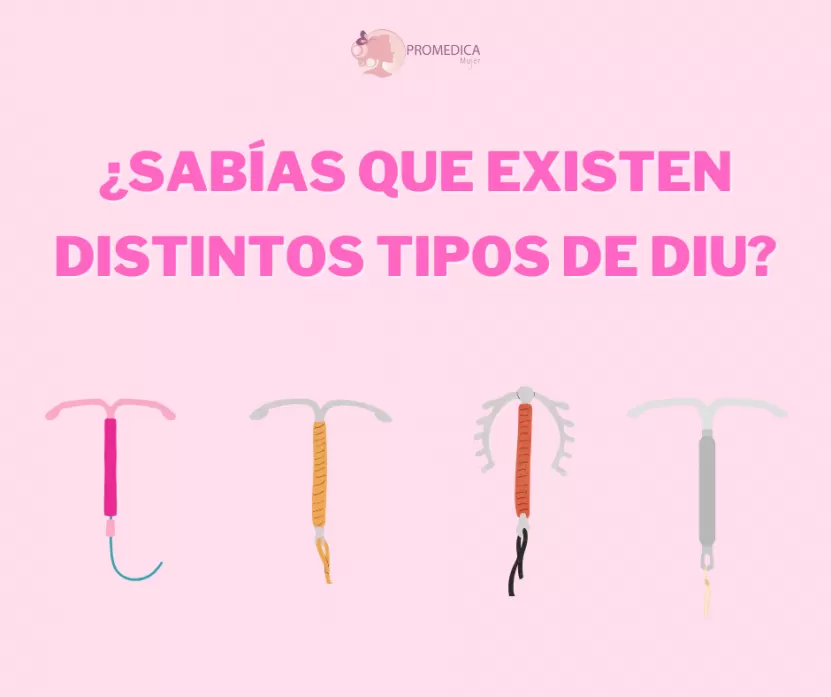 Foto de ¿Sabías que hay distintos tipos de DIU? Descubre cuál es el mejor para ti