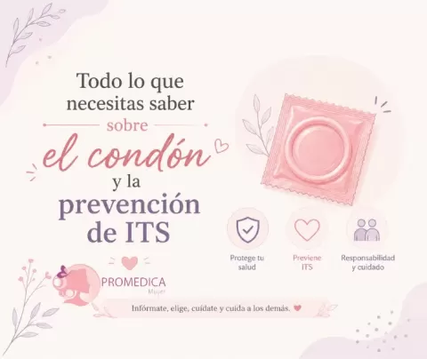 Todo lo que necesitas saber sobre el condón y la prevención de ITS