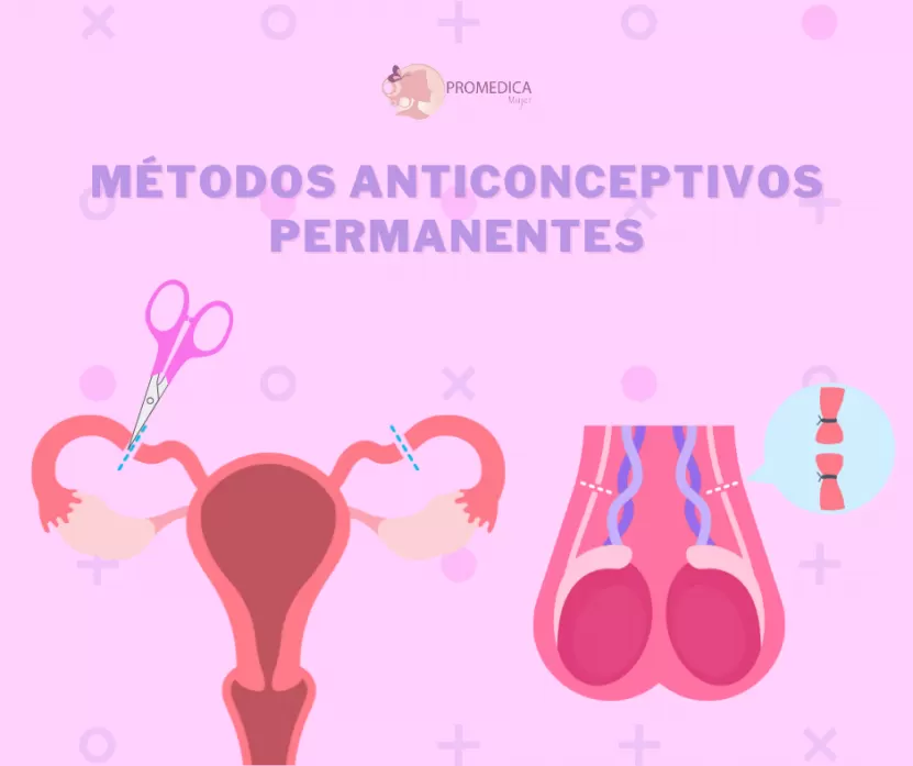 Foto de Métodos anticonceptivos permanentes: opciones, ventajas y consideraciones