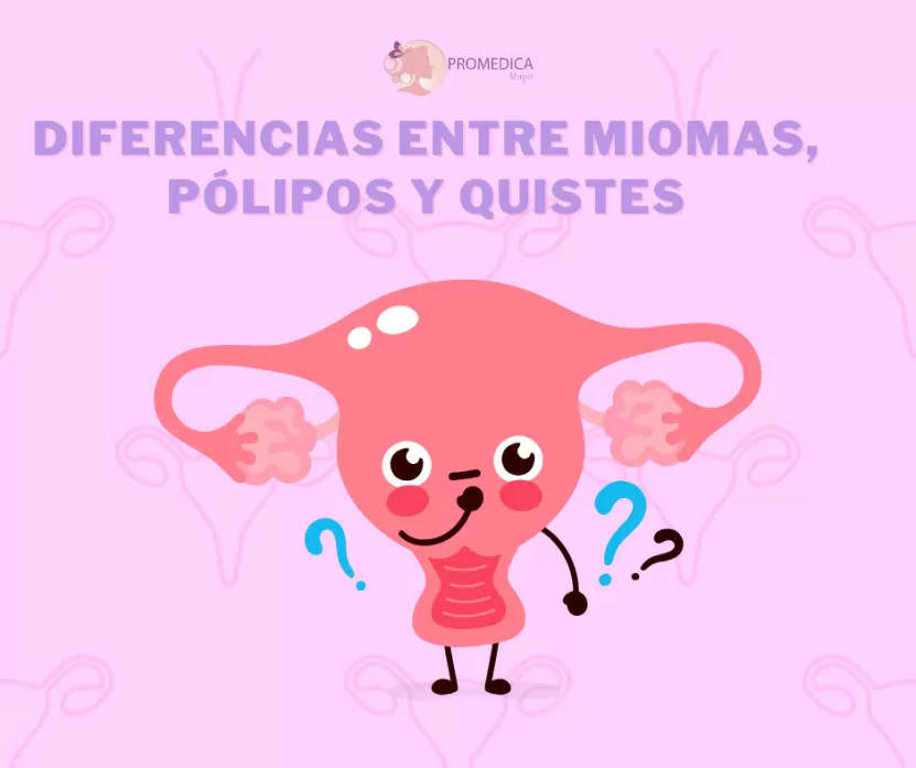 Foto de Miomas, quistes y pólipos uterinos: ¿en qué se diferencian?