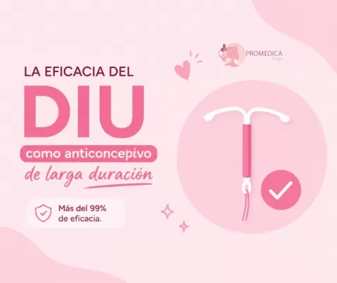 Guía Completa sobre el DIU: El Anticonceptivo de Larga Duración