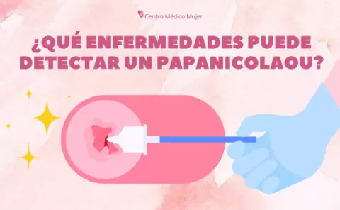 El Papanicolaou: el examen básico de salud femenina