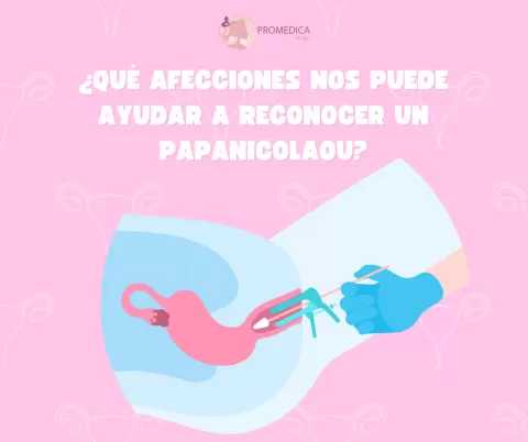 ¿Qué enfermedades puede detectar un papanicolaou?