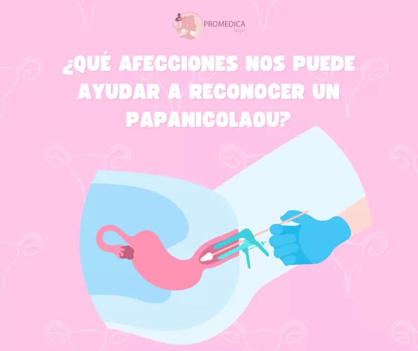 Foto de ¿Qué enfermedades puede detectar un papanicolaou?