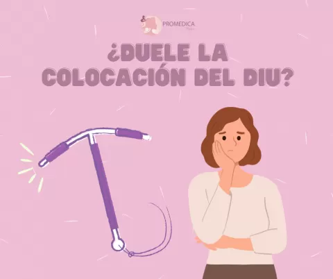 ¿Duele la colocación de un DIU? Todo lo que necesitas saber