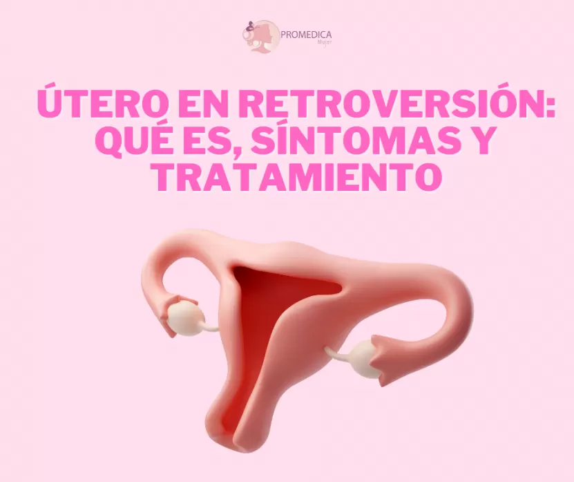 Foto de Útero en retroversión: qué es, síntomas y tratamiento