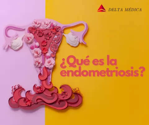 ¿Qué es la endometriosis?