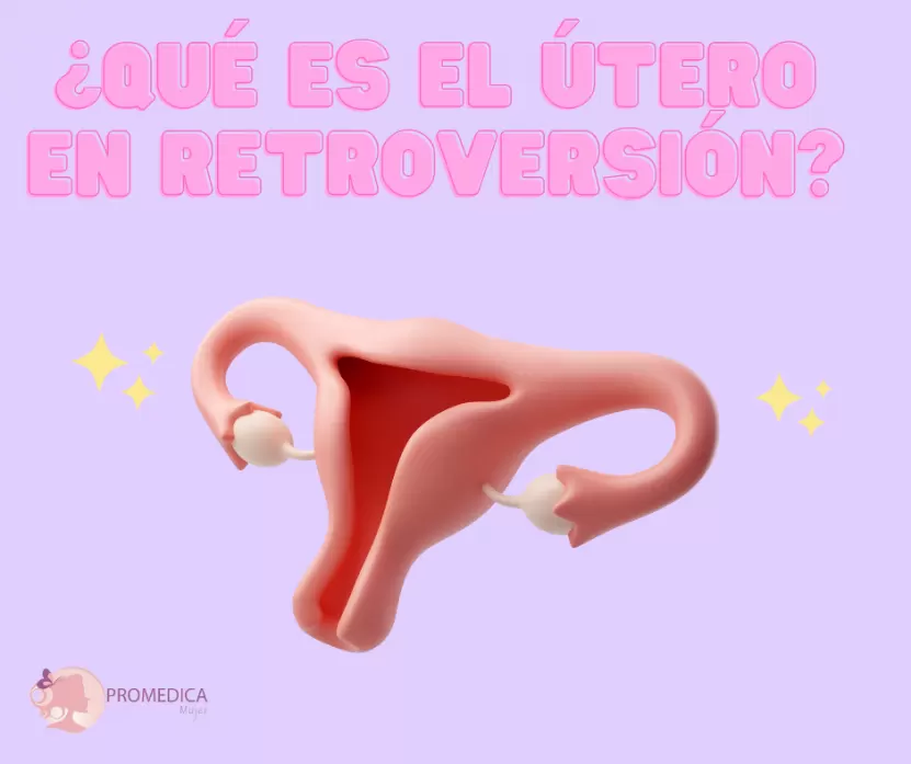 Foto de ¿Qué implica tener el útero en retroversión o invertido?