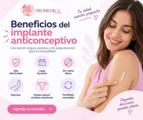Implante anticonceptivo: beneficios, duración y cómo funciona
