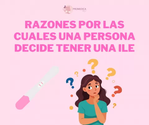 Razones por las cuales una persona decide tener una ILE