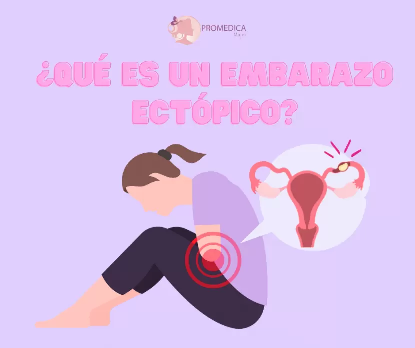 Foto de ¿QUÉ ES UN EMBARAZO ECTÓPICO?