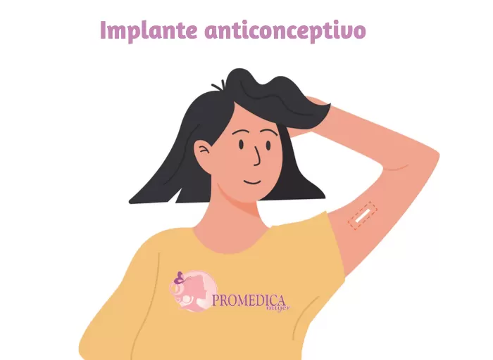 Foto de Todo lo que tienes que saber sobre el implante anticonceptivo