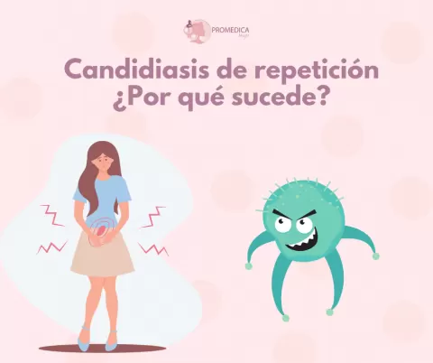 Cómo Manejar y Prevenir la Candidiasis Vaginal Recurrente