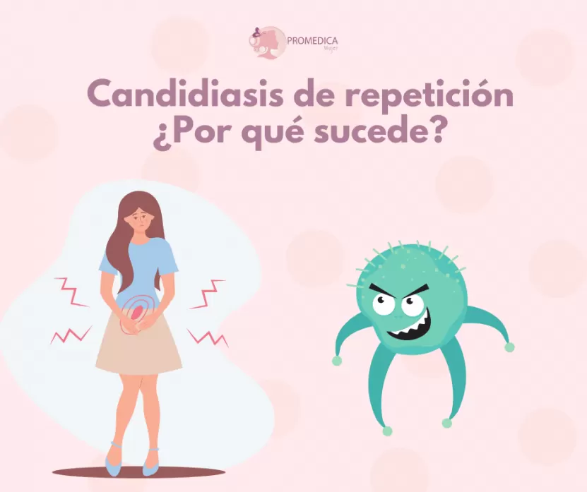 Foto de Cómo Manejar y Prevenir la Candidiasis Vaginal Recurrente
