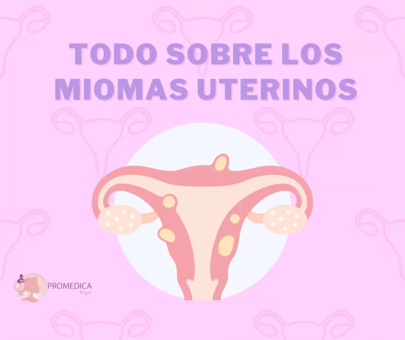 Foto de Miomas Uterinos: Detección, Síntomas y Opciones de Tratamiento