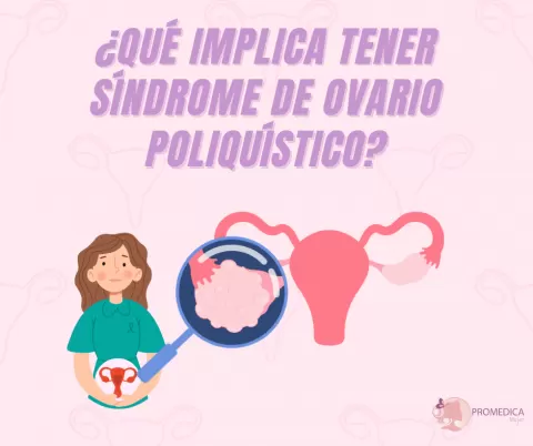 ¿Qué implica tener síndrome de ovario poliquístico (SOP)?