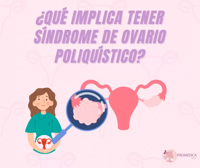 Foto de ¿Qué implica tener síndrome de ovario poliquístico (SOP)?