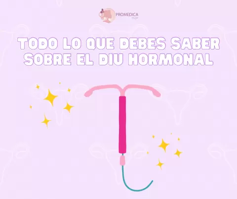 DIU Hormonal: funcionamiento, beneficios y efectividad