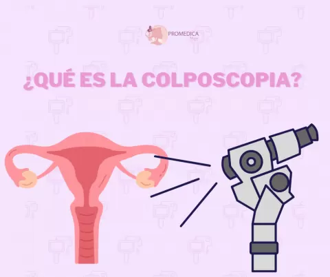 Colposcopia: ¿Qué es y por qué puede ser necesaria?