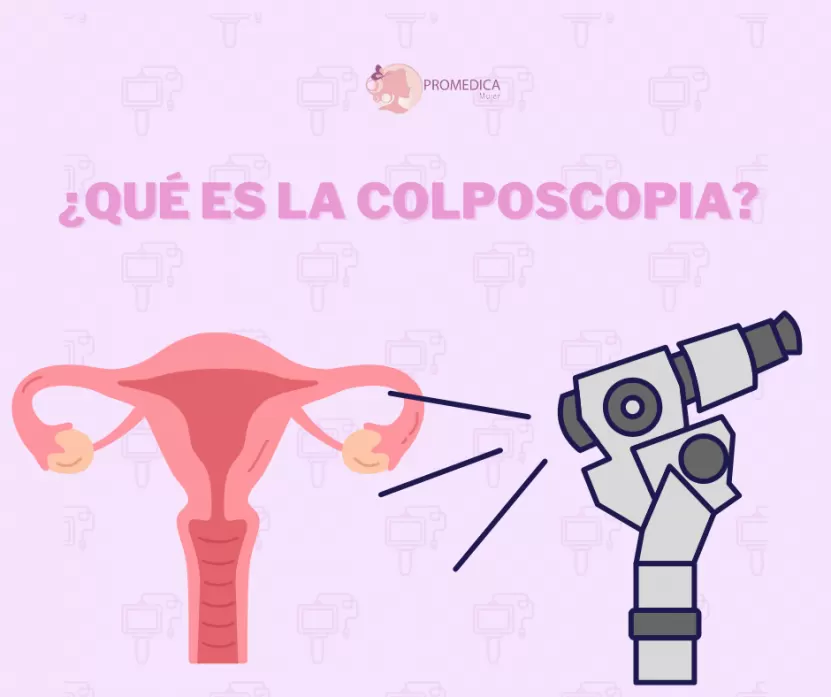 Foto de Colposcopia: ¿Qué es y por qué puede ser necesaria?