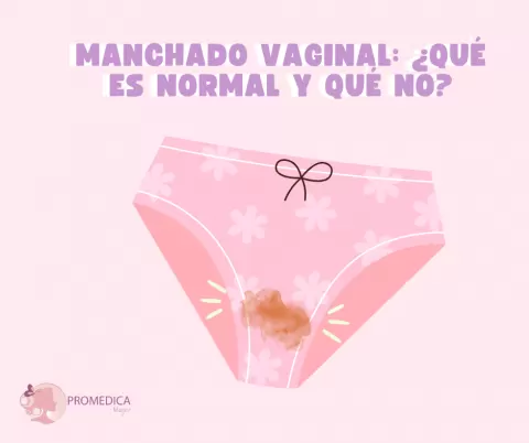 Manchado vaginal: ¿qué es normal y qué no?