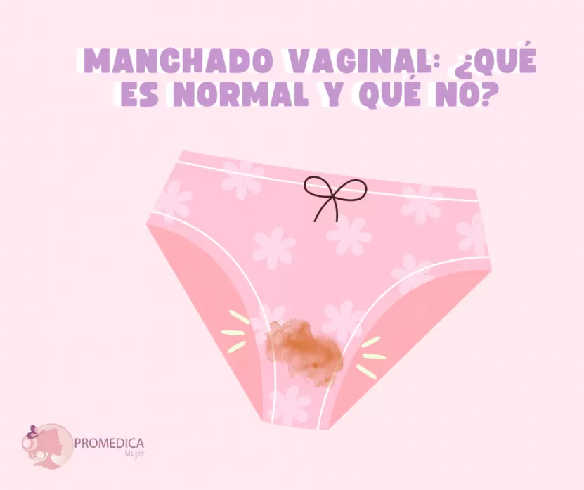 Foto de Manchado vaginal: ¿qué es normal y qué no?
