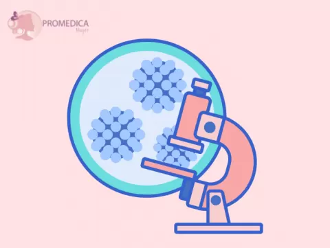 Síntomas del Papiloma Humano VPH