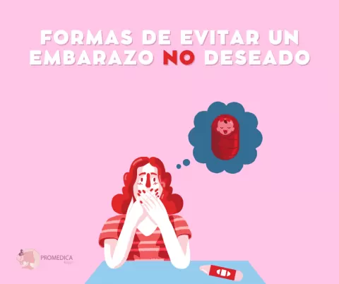 Métodos para prevenir un embarazo no deseado